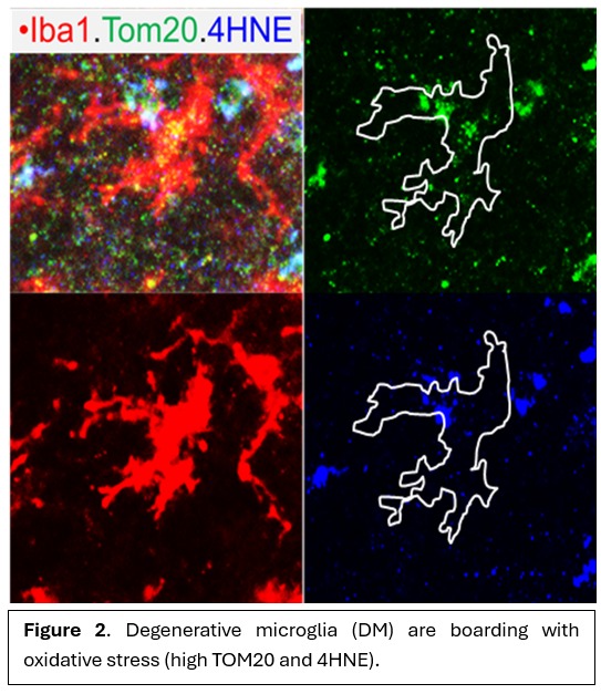 Diagram of iron dysregulation driving microglial ferroptosis and oligodendrocyte lineage damage that leads to white matter injury