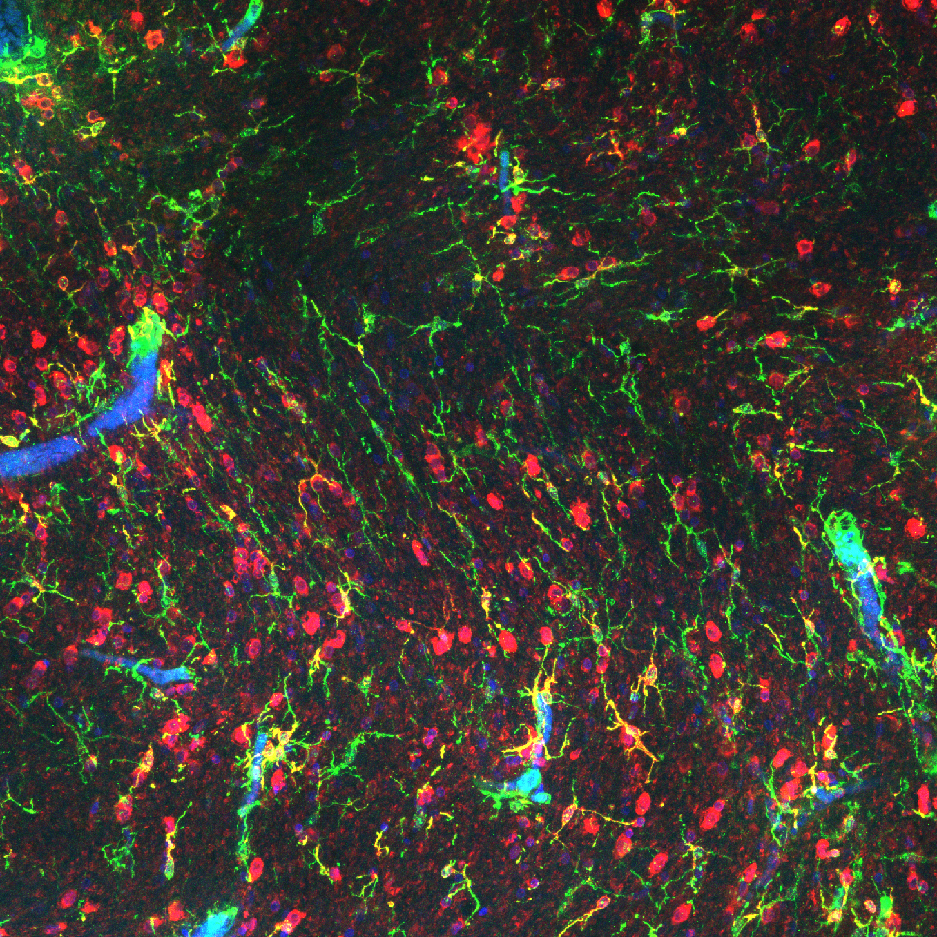 Illustration of the cerebral vasculature within the brain