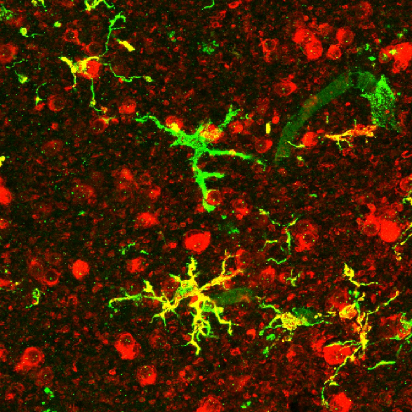 Aging & Neurodegeneration